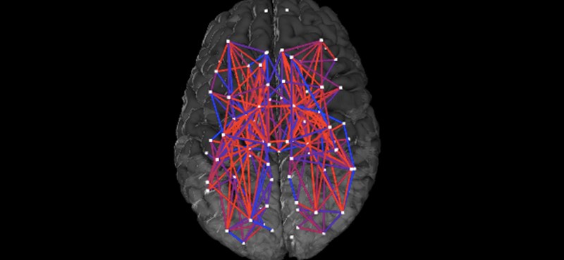 Az ELTE kutatói fogtak 470 embert, és csináltak egy térképet az agyuk kapcsolataiból