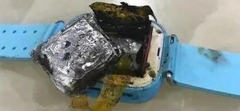 +18: Causó una quemadura fea en el brazo de una niña pequeña que explotó en un reloj inteligente.
