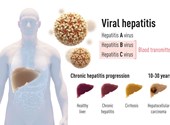 2020 Nobel Prize in Physiology and Medicine awarded for the discovery of the hepatitis C virus