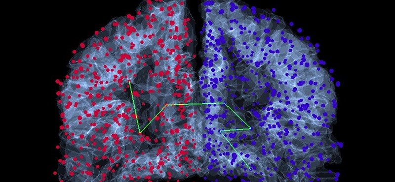 Érdekes dolgokat azonosítottak az agyban a ELTE matematikusai