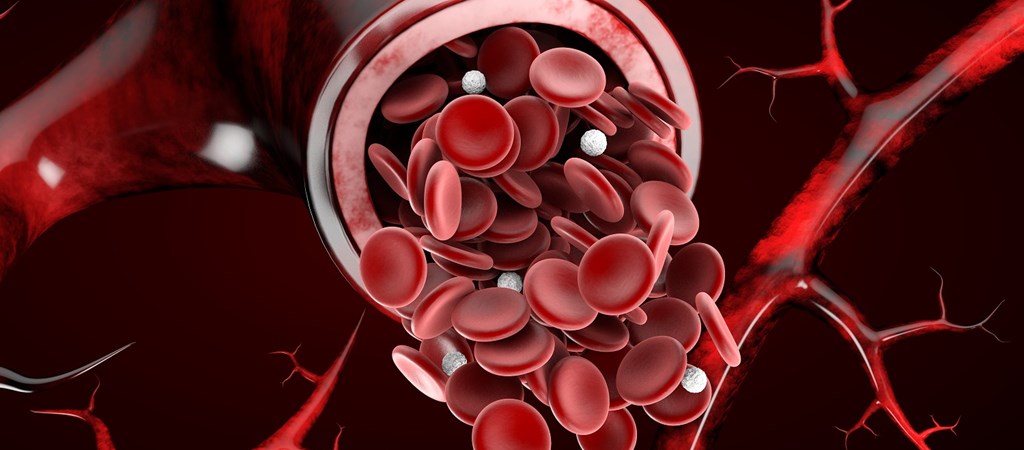 Székelés utáni vérzések: honnan származnak?