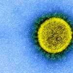 Brazil continues to test the Chinese coronavirus vaccine